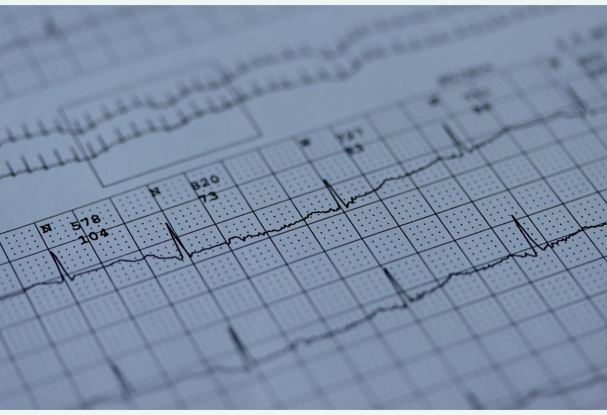 ECG cardiology diagnostics