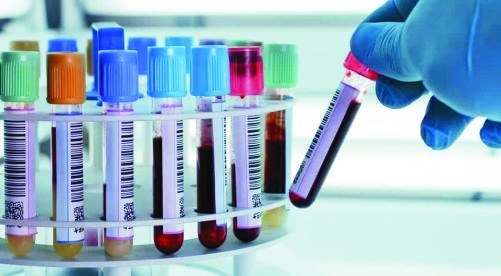 Pathology blood samples